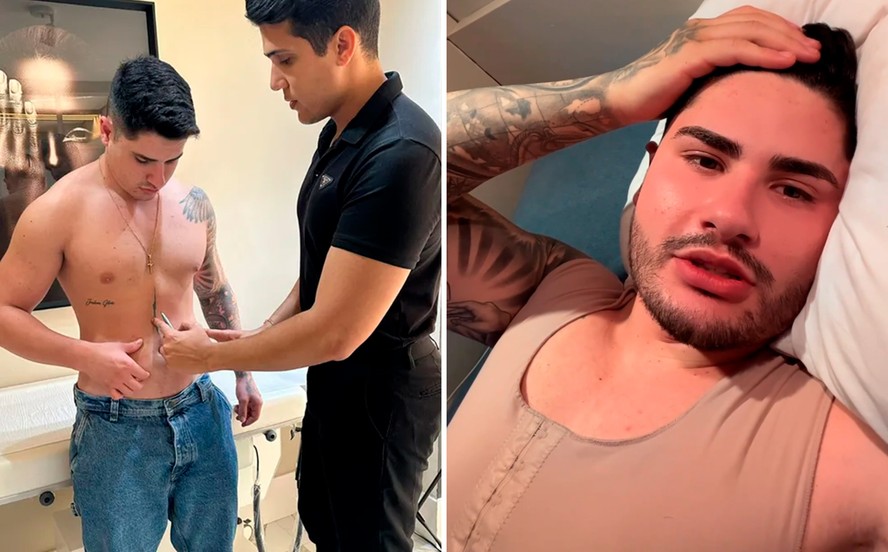 Lucas Souza ex de Jojo passa por lipo HD para ganhar tanquinho