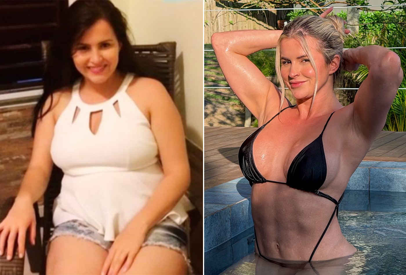 Influencer mostra antes e depois de perder 20 kg e diz ter canetafobia | Saude | QTU Notícias