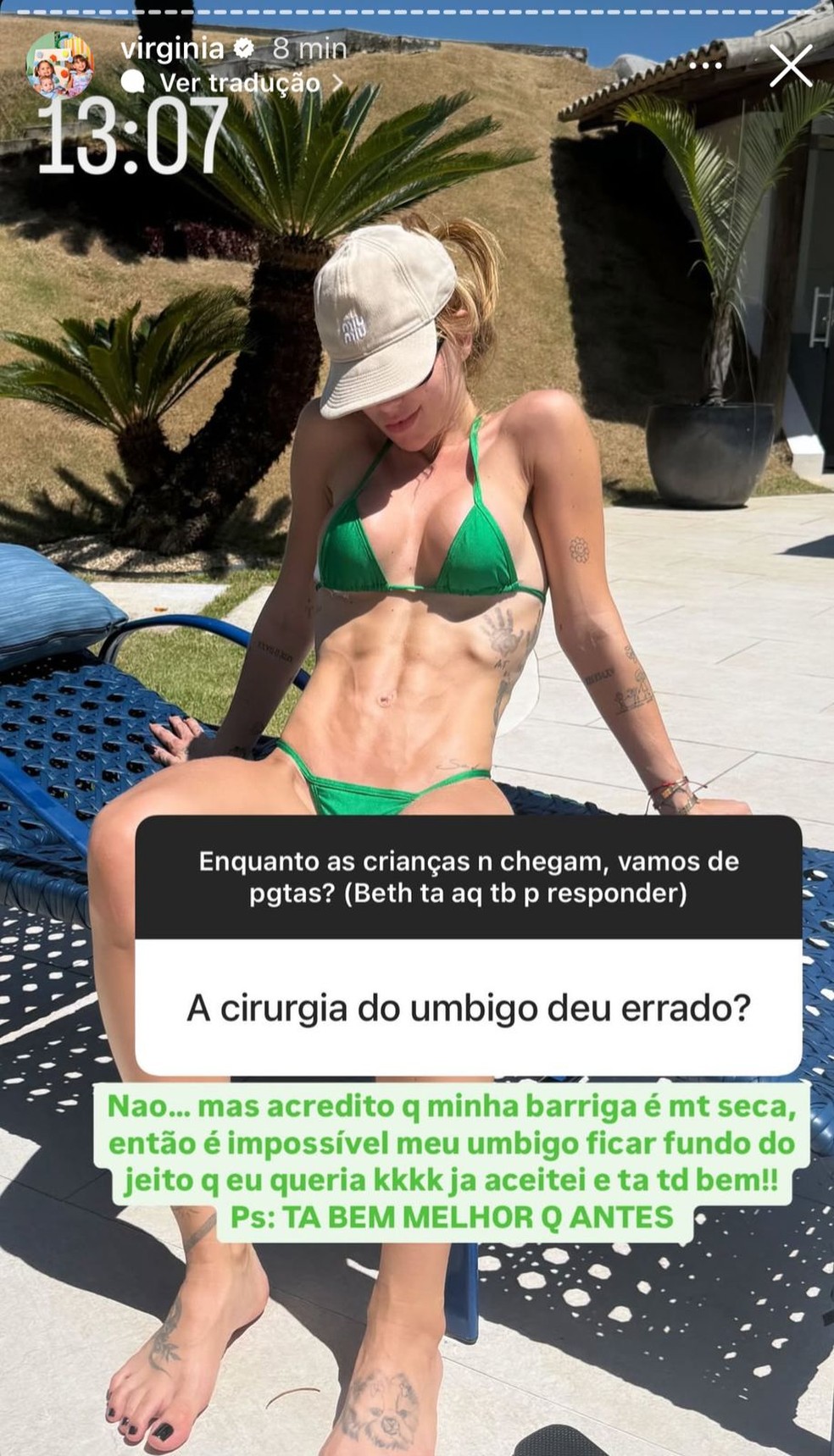 Após cirurgia, Virginia Fonseca diz ser impossível ter o umbigo do jeito  que queria: Já aceitei