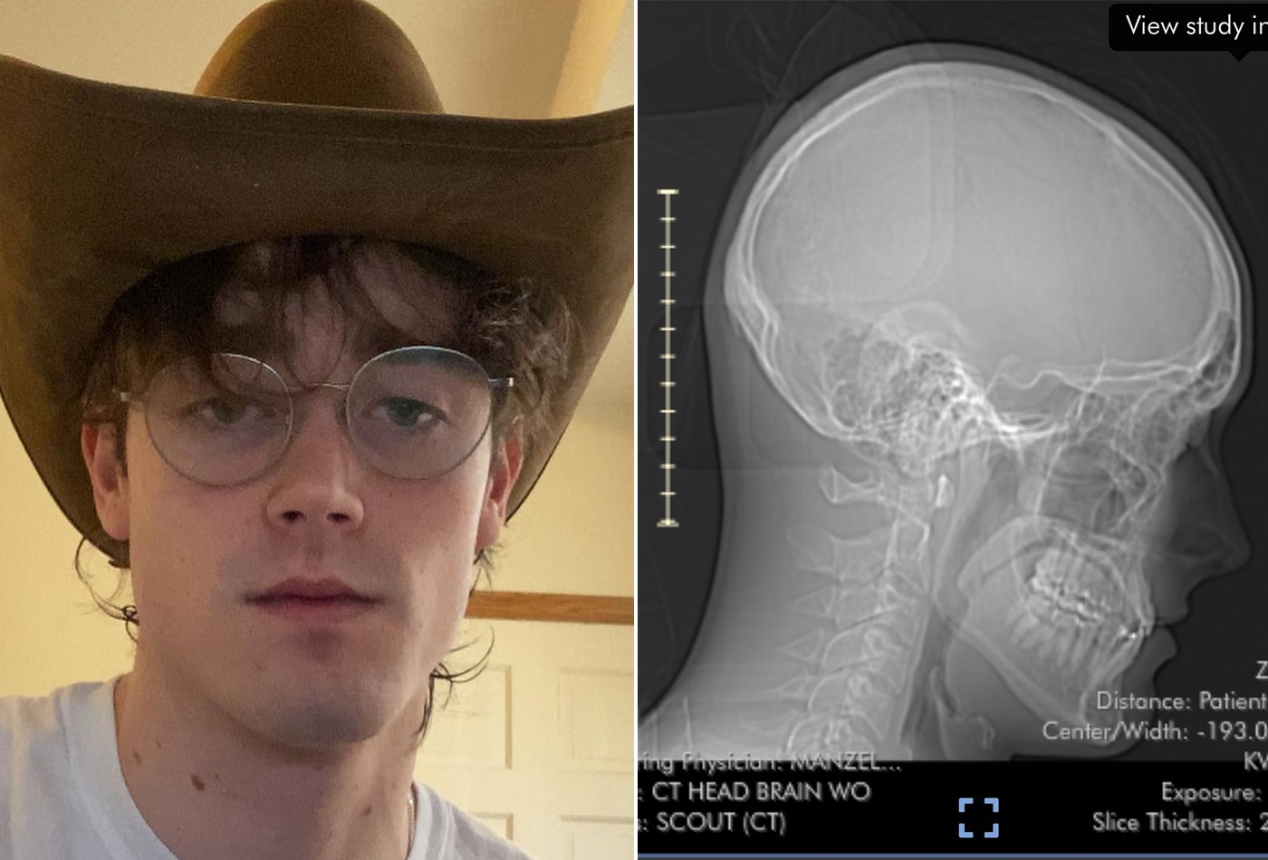 Músico ficará acordado para retirar tumor no cérebro em cirurgia de 6 hs