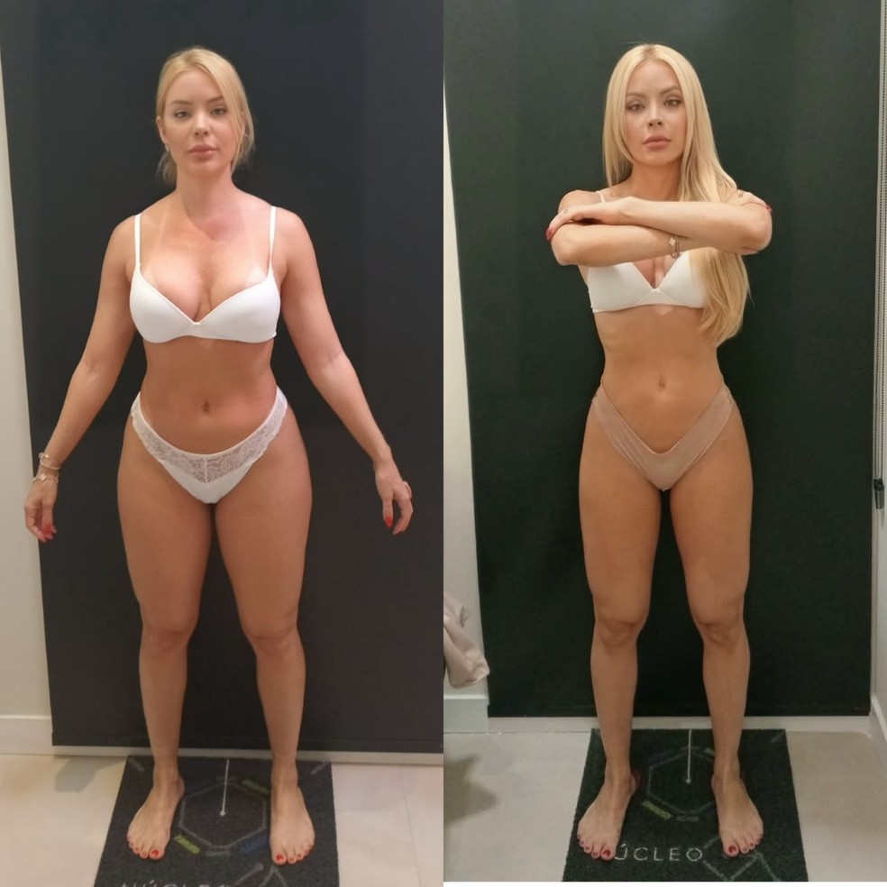 Denise Dias: Antes e depois — Foto: Divulgação