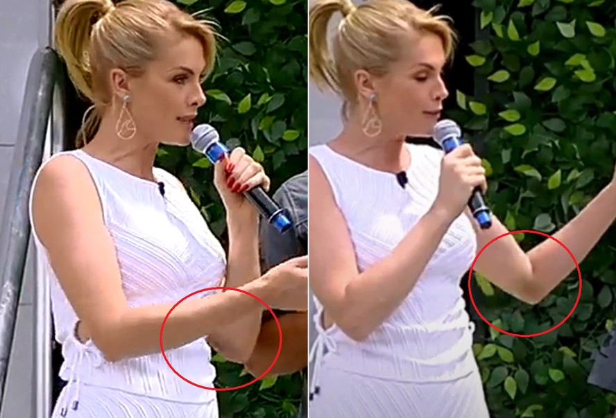 Ana Hickmann apresentou programa com hematoma no braço; vídeo
