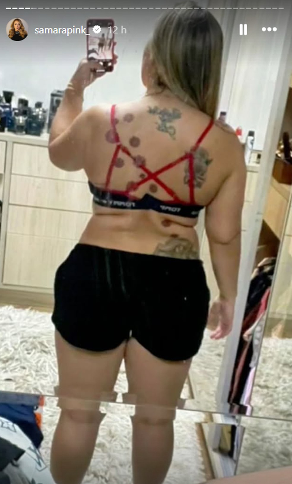 Sócia de Virginia Fonseca mostra antes e depois do corpo e impressiona com a transformação — Foto: Reprodução/Instagram