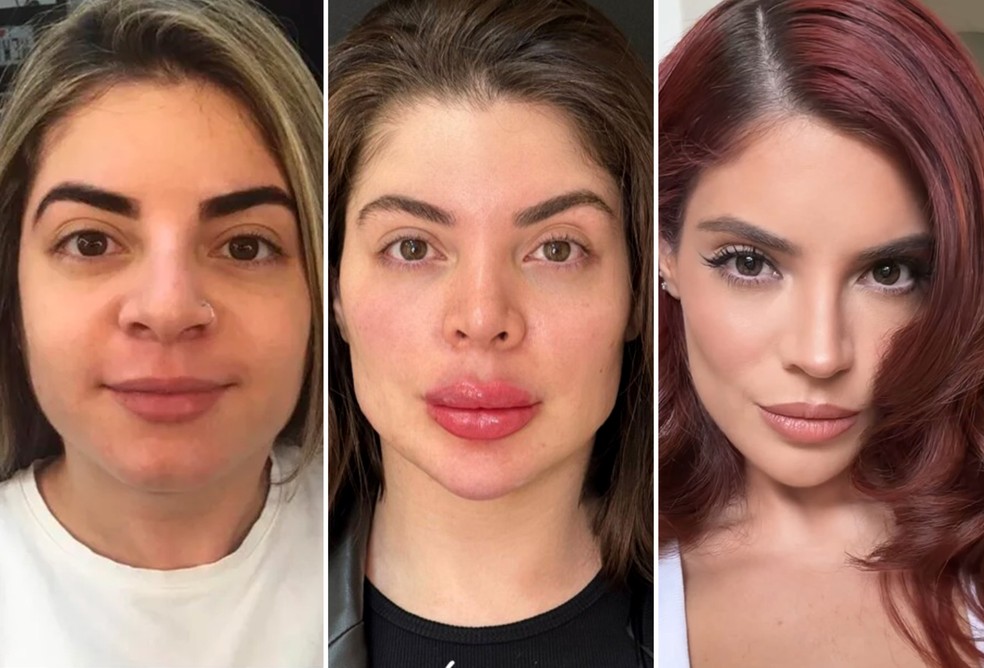 Gkay antes dos procedimentos, depois e hoje, após retirada — Foto: Reprodução/ Instagram