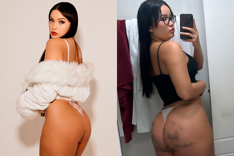 Antes e depois do bumbum da musa do OnlyFans Lina Nakamura — Foto: Divulgação