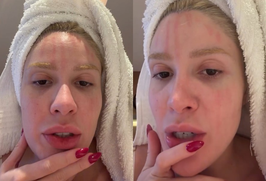 Karoline Lima mostra perrengue com sangue falso