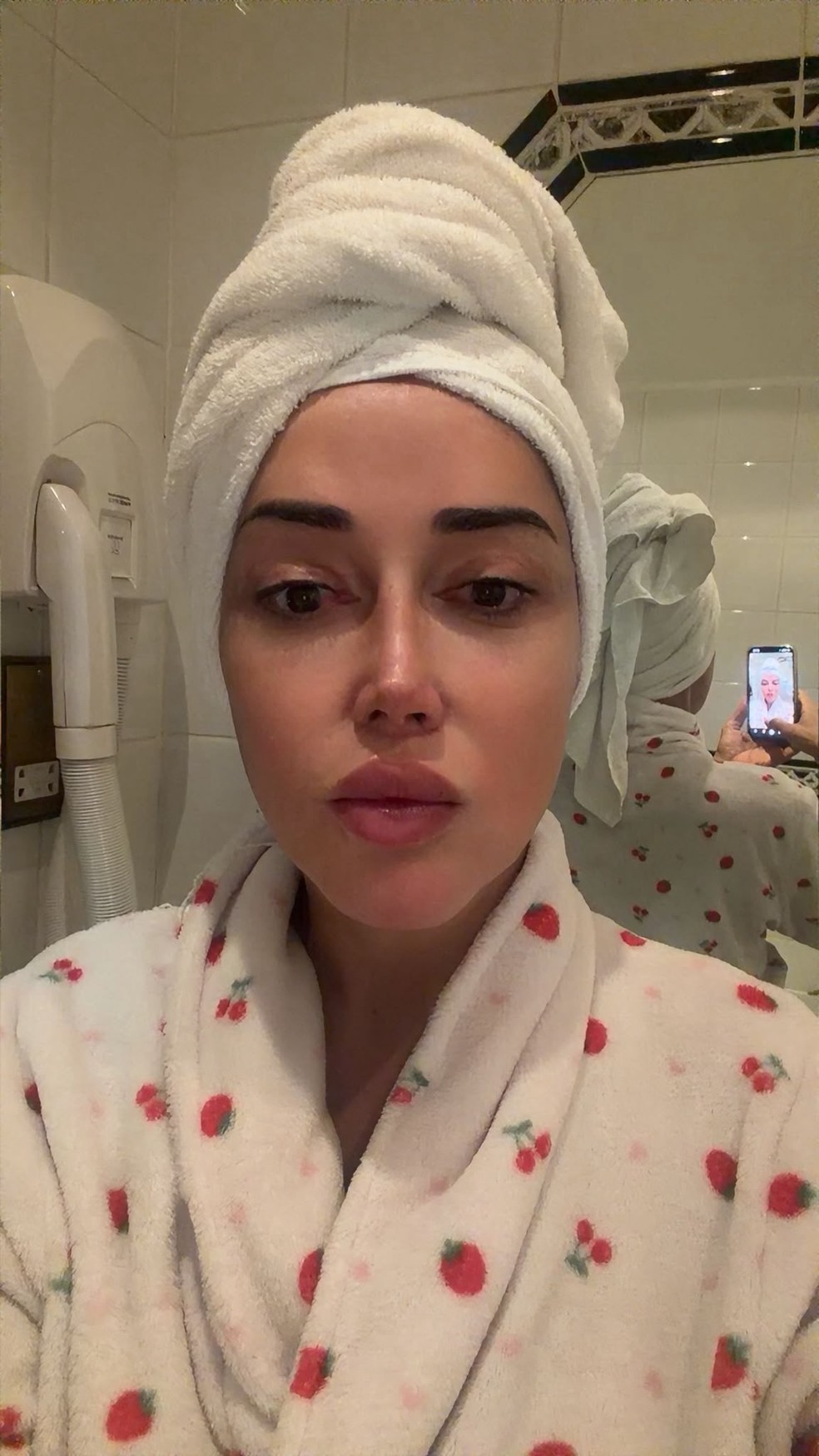 Marcela Porto, a Mulher Abacaxi, depois da feminização facial — Foto: Arquivo pessoal