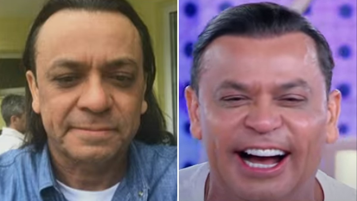 Frank Aguiar mostrou antes e depois da harmonização facial em programa de TV — Foto: Reprodução/SBT