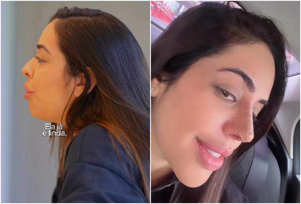 Antes e depois de Flavinha Correia — Foto: Reprodução/Instagram