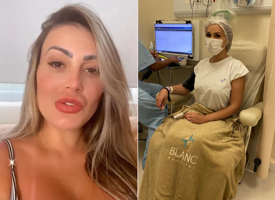 Andressa Urach Se Interna Para Lipoaspira O Oito Anos Ap S Complica Es De Aplica O De Hidrogel