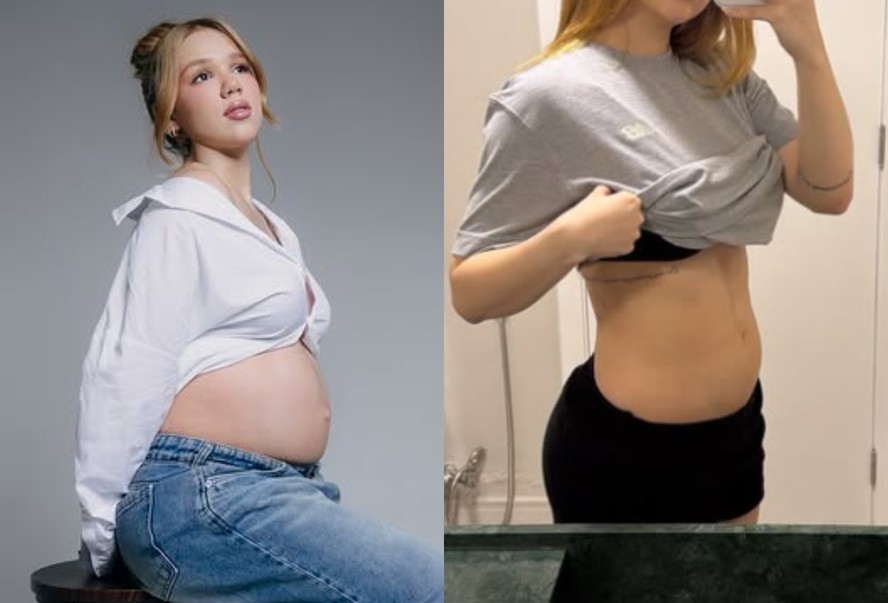 Julia Ribeiro mostra evolução da barriga uma semana após parto