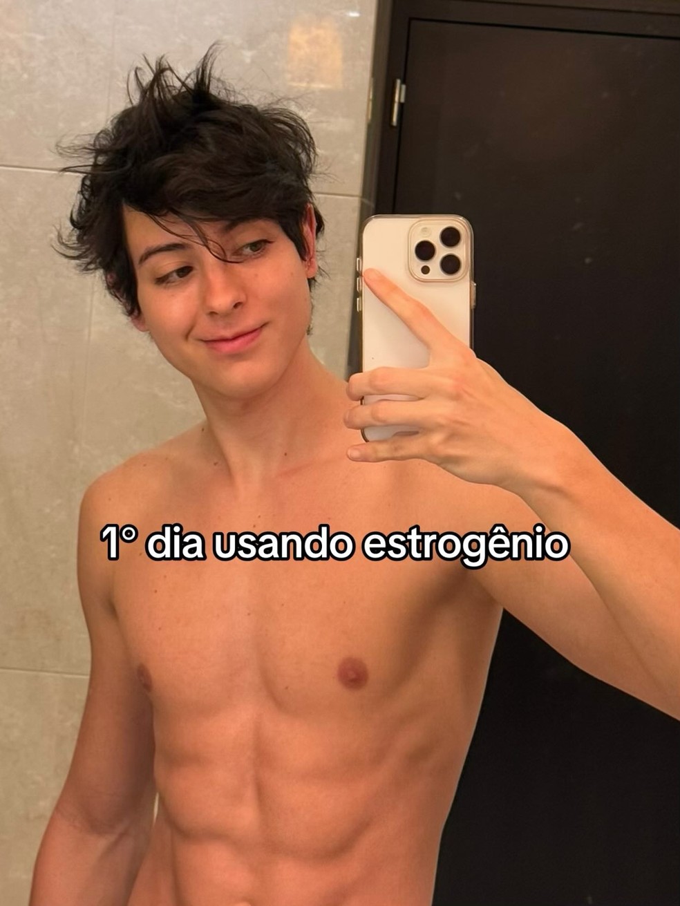 Bella Longuinho antes de transição de gênero e quando começou a usar estrogênio — Foto: Reprodução/Instagram