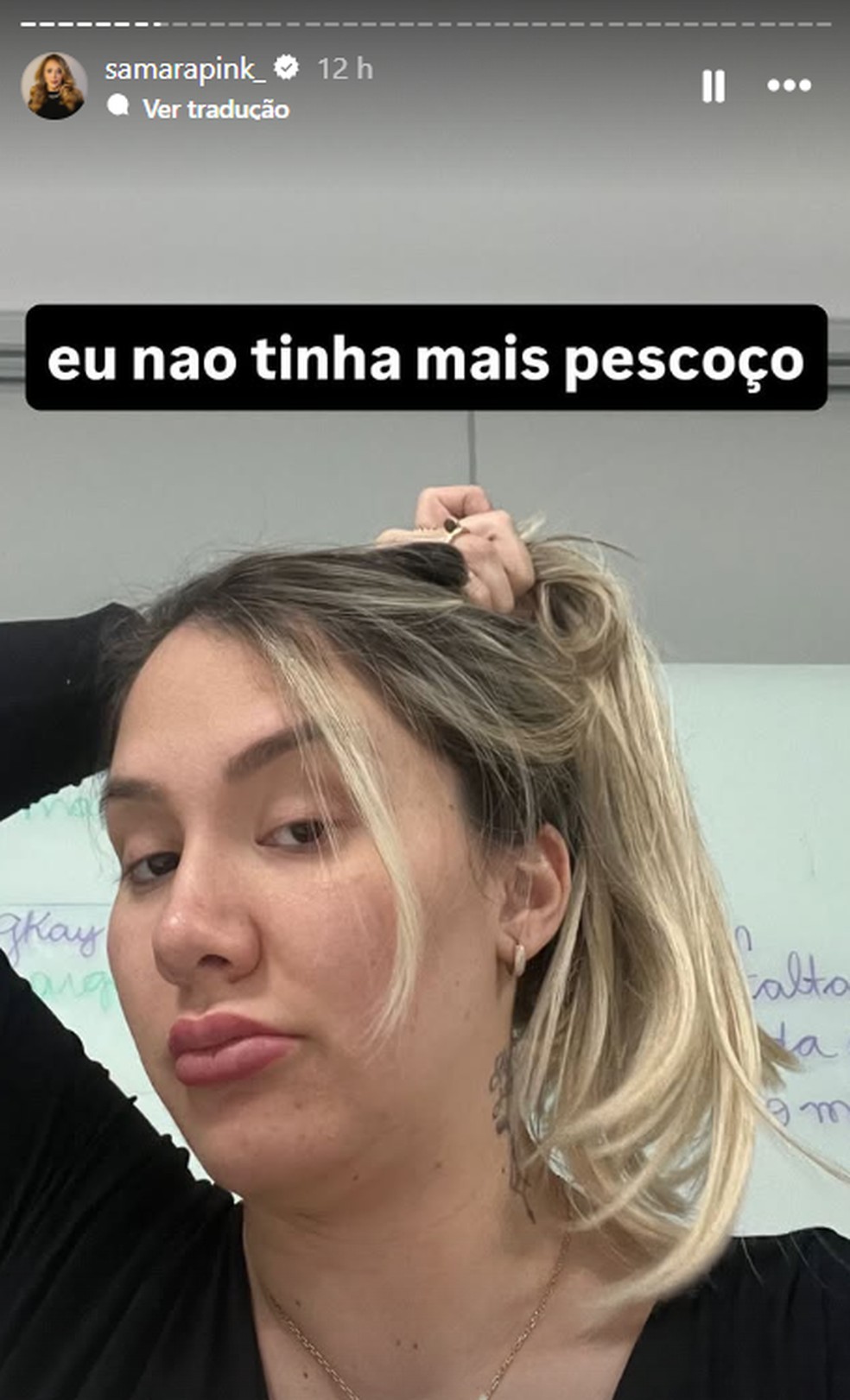 Sócia de Virginia Fonseca mostra antes e depois do corpo e impressiona com a transformação — Foto: Reprodução/Instagram