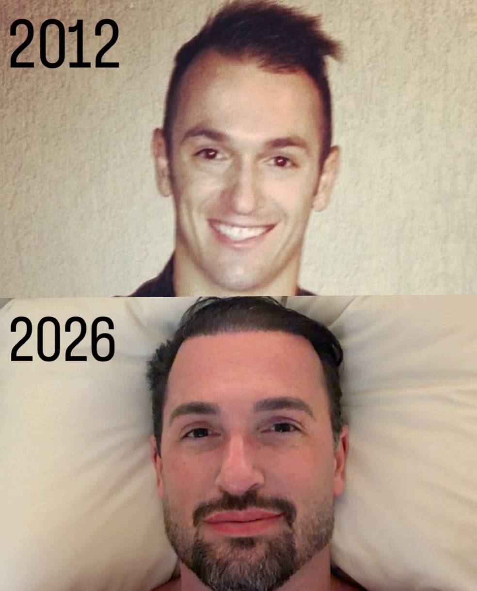 Antes e depois de Diego Hypolito — Foto: Reprodução/Instagram