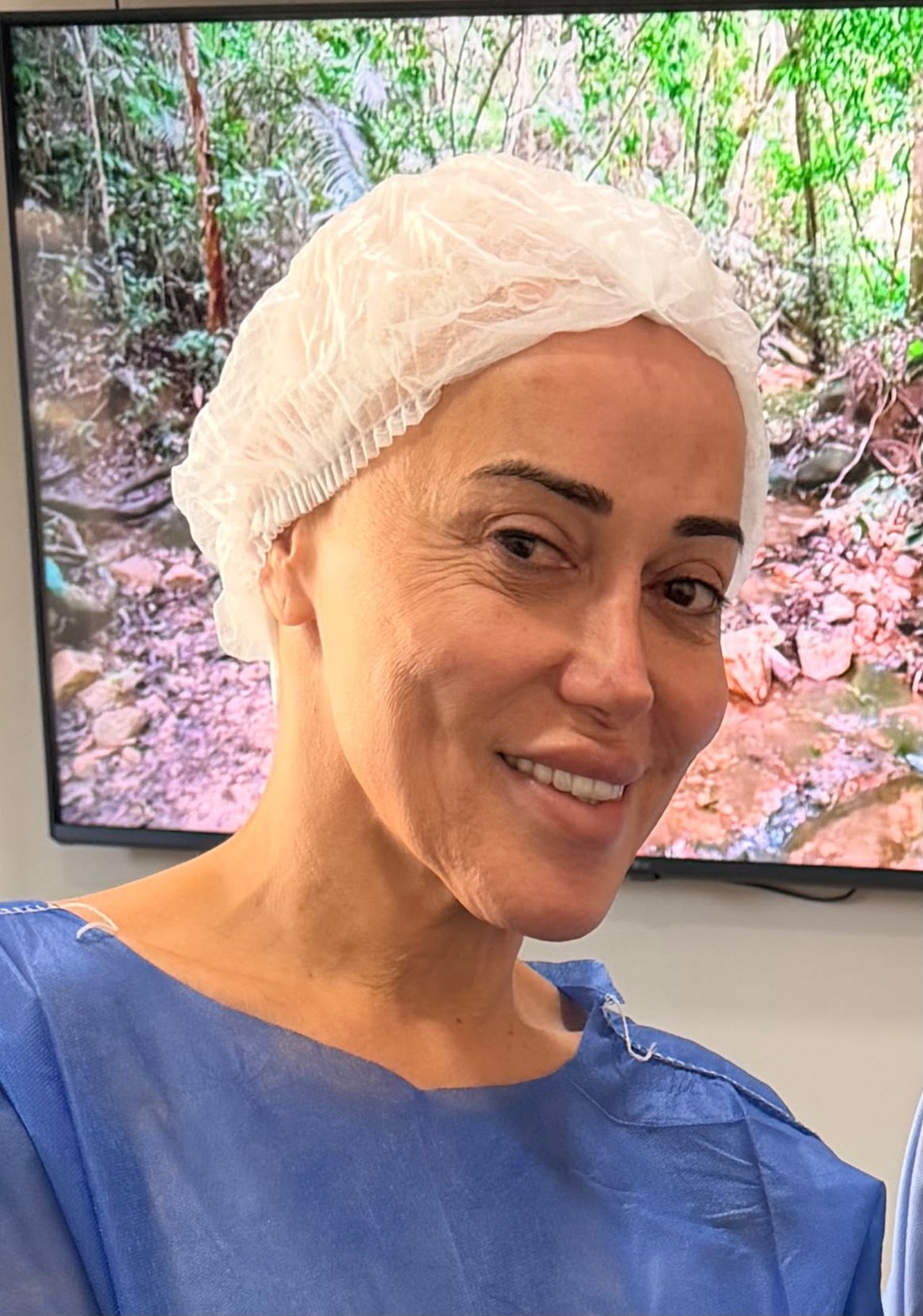 Marcela Porto, a Mulher Abacaxi, antes da feminização facial — Foto: Arquivo pessoal