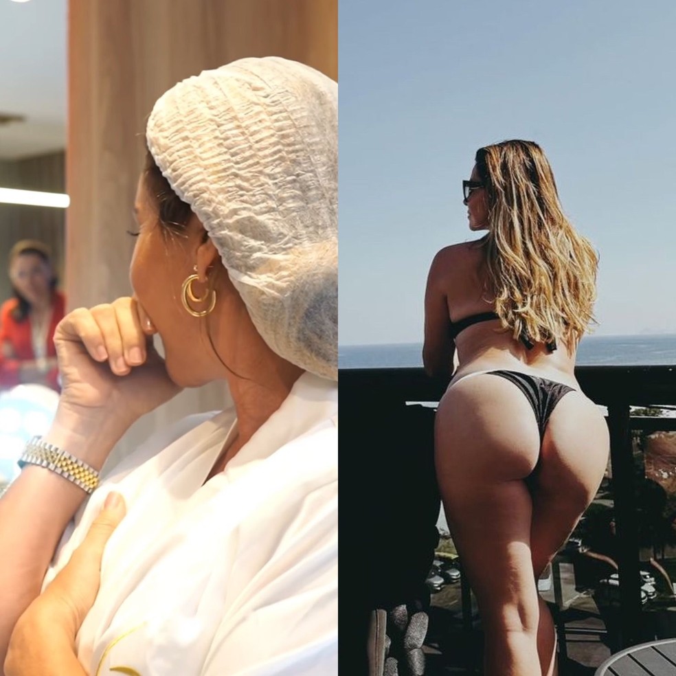 Giovanna Antonelli faz tratamento para celulite — Foto: Divulgação Clínica Leger e Reprodução/Instagram