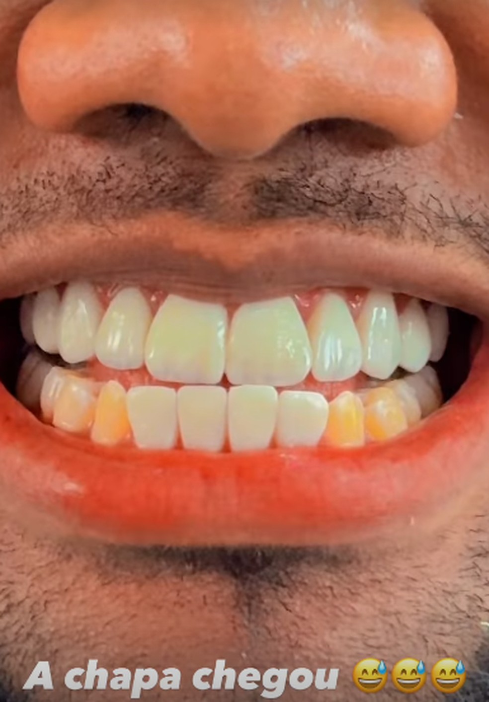 Davi Brito mostra dentes — Foto: Reprodução/Instagram