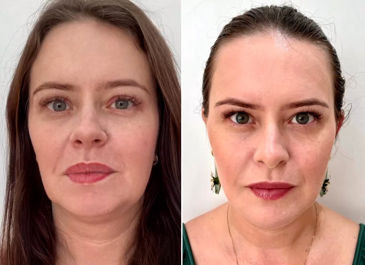 Antes e depois de Mari Bridi — Foto: Reprodução/ Instagram