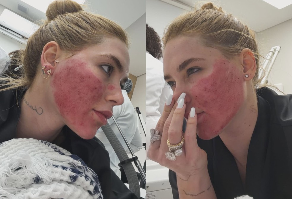 Virginia Fonseca mostra resultado — Foto: Reprodução/Instagram