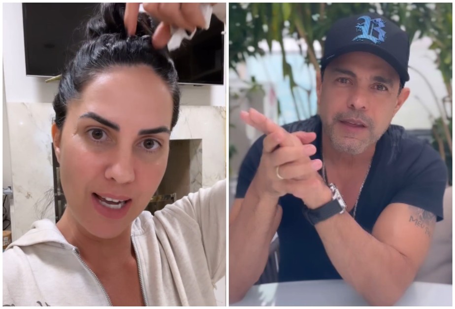 Graciele Lacerda diz que Zezé Di Camargo raspou a cabeça para procedimento:  'Tem vergonha'