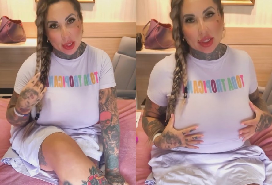 Sabrina Boing Boing Detalha Cirurgia Em Que Colocou 6 Litros De Silicone Nos Seios 5357