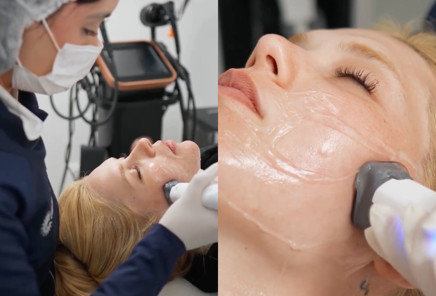 Virginia gasta fortunas em estética ao lado de Vini Jr