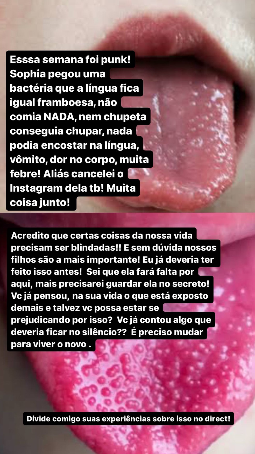 Maíra Cardi mostra bactéria na língua da filha — Foto: Reprodução/Instagram