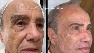 O antes e depois de Stênio Garcia — Foto: Reprodução Instagram