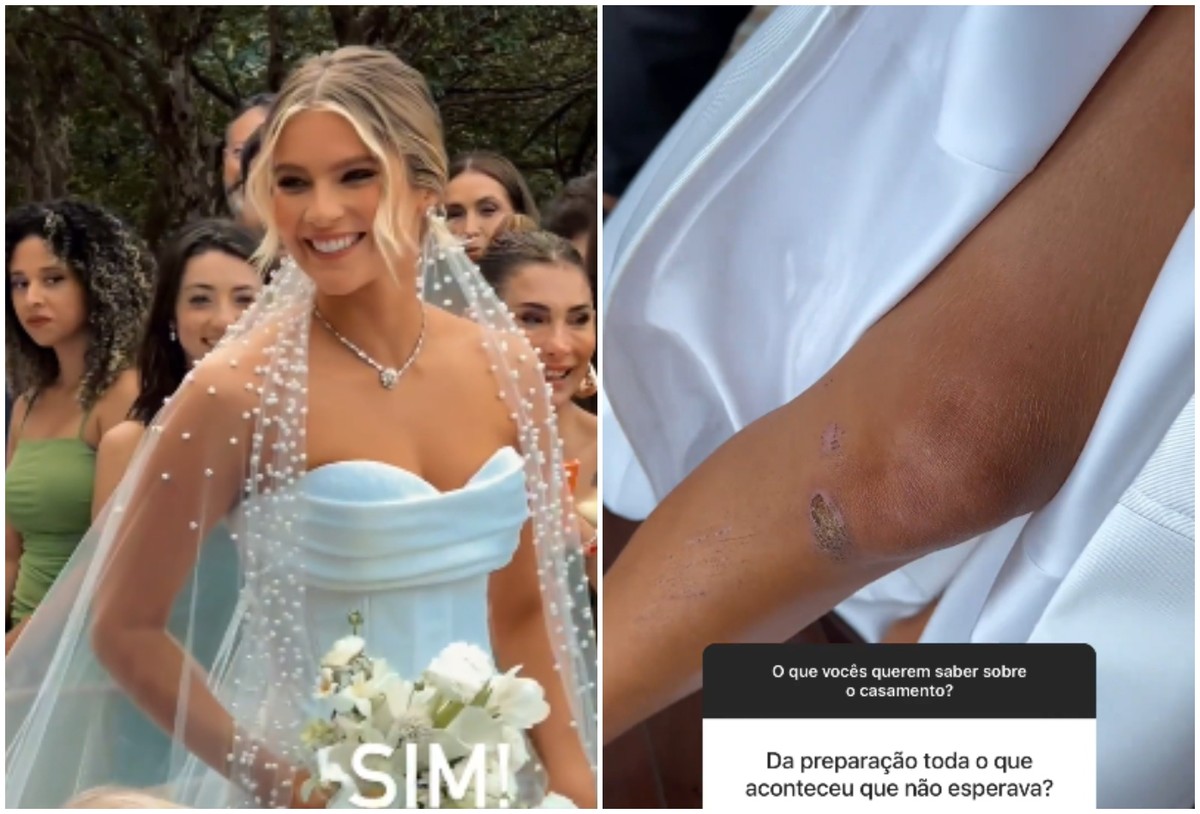 Isabella Santoni says she was injured before her wedding;  Video |  wedding parties