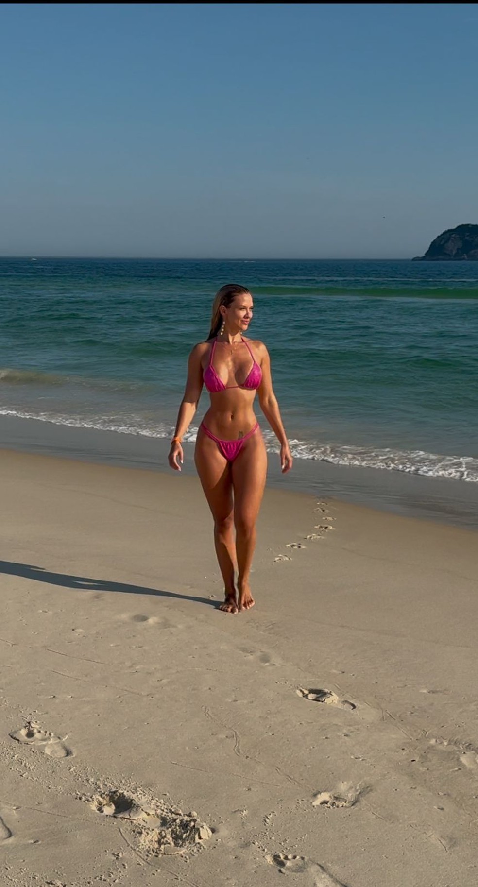 Concurso de beleza exige, e 'Miss Cinturinha' faz raio-X para provar