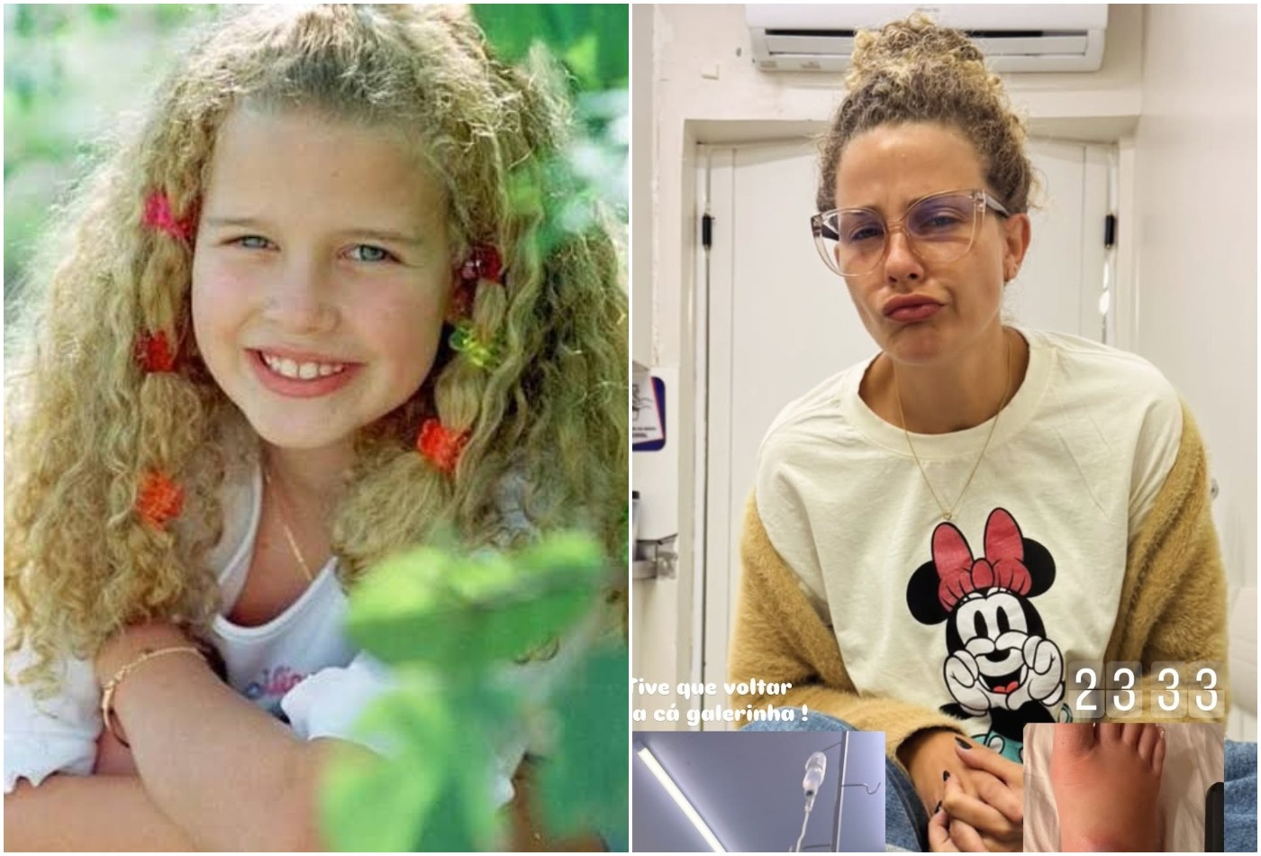 Ex-atriz mirim, Debby Lagranha vai parar no hospital ao ser picada por aranha