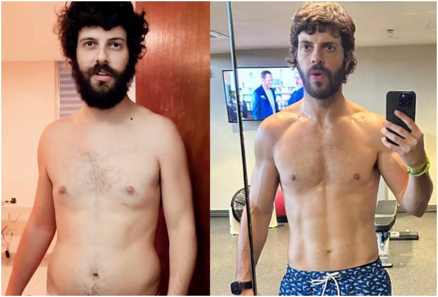 Diogo Defante mostra antes e depois do corpo e fala sobre retirada de tumor; veja