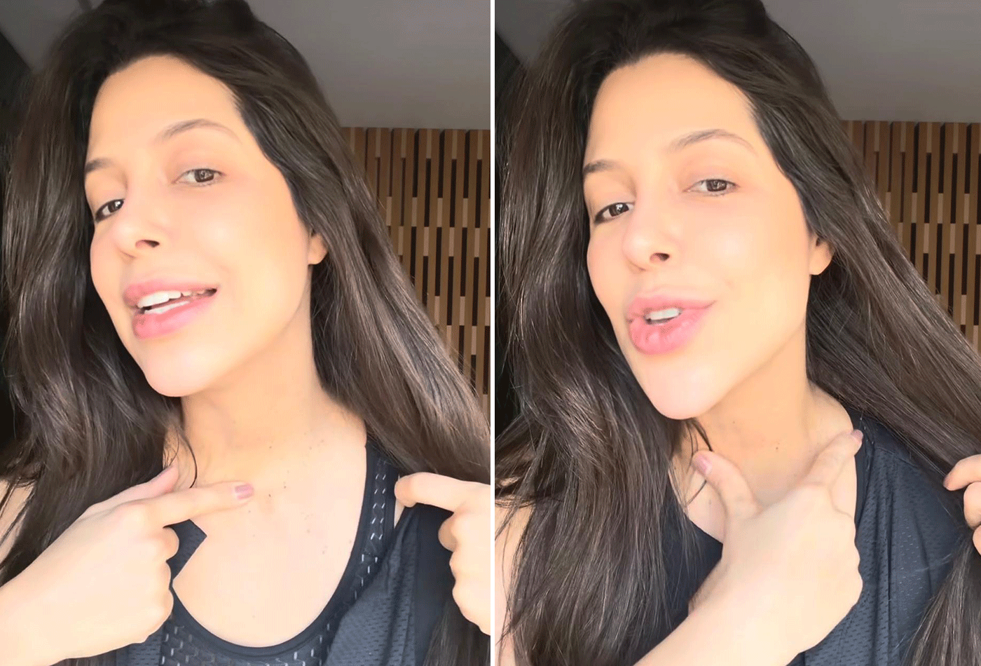 Laís Caldas revela incômodo com lesões de pele: "Aumentou ainda mais na minha gestação" - QTU Questões do Universo