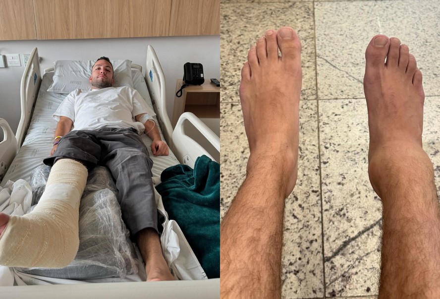 Lucas Rangel se machuca e passa por cirurgia a menos de um mês para o ...