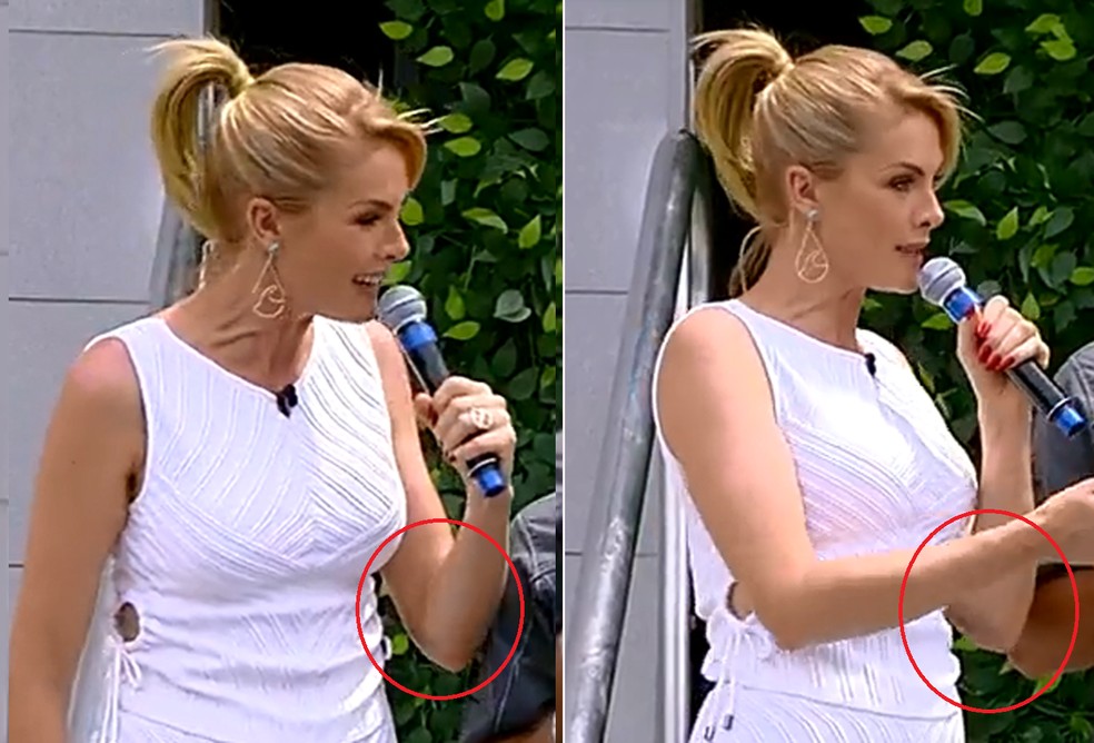 Ana Hickmann apresenta 'Hoje em Dia' com hematoma no braço — Foto: Reprodução Twitter / Hoje em Dia