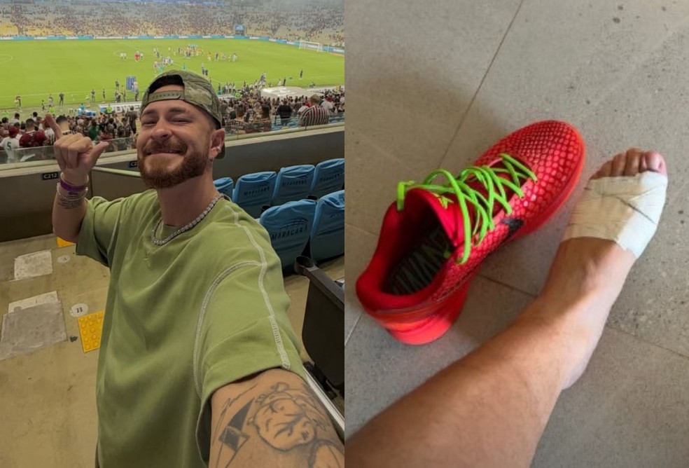 Fred Bruno mostra pé enfaixado após levar tiro de raspão — Foto: Reprodução/Instagram
