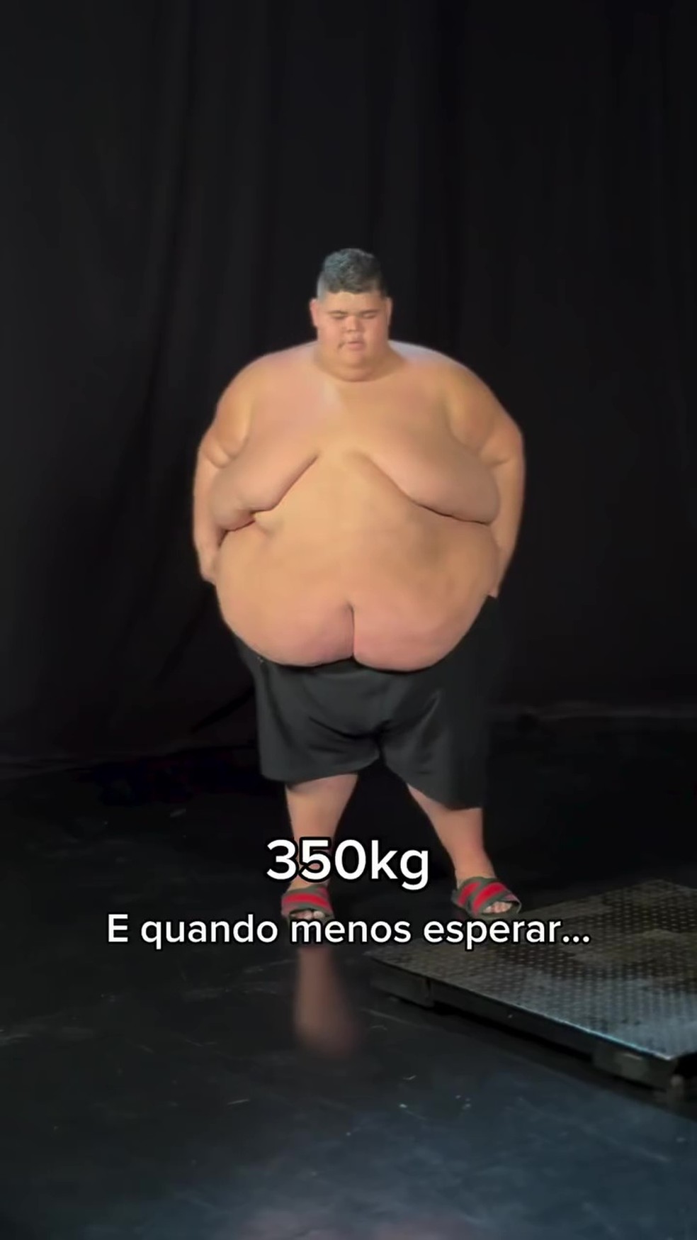 Antes de Gordão da XJ, ainda com 350 kg — Foto: Reprodução/Instagram