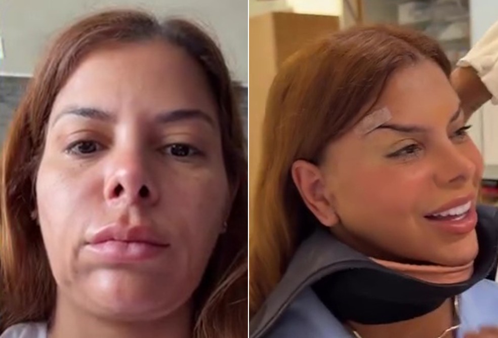 Antes e depois de Evelyn Regly — Foto: Reprodução/Instagram
