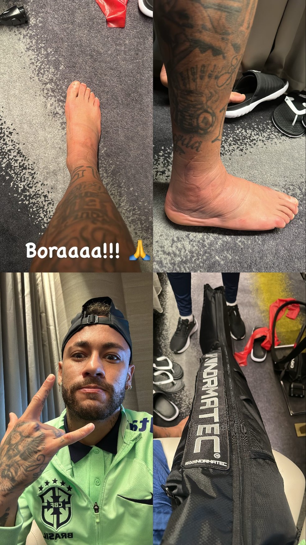 Neymar mostra inchaço de pé neste sábado — Foto: Reprodução do Instagram