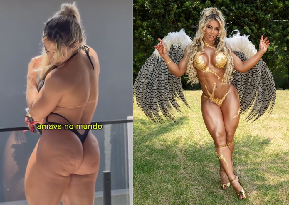 Antes e depois de Vivi Winkler — Foto: Reprodução | Instagram