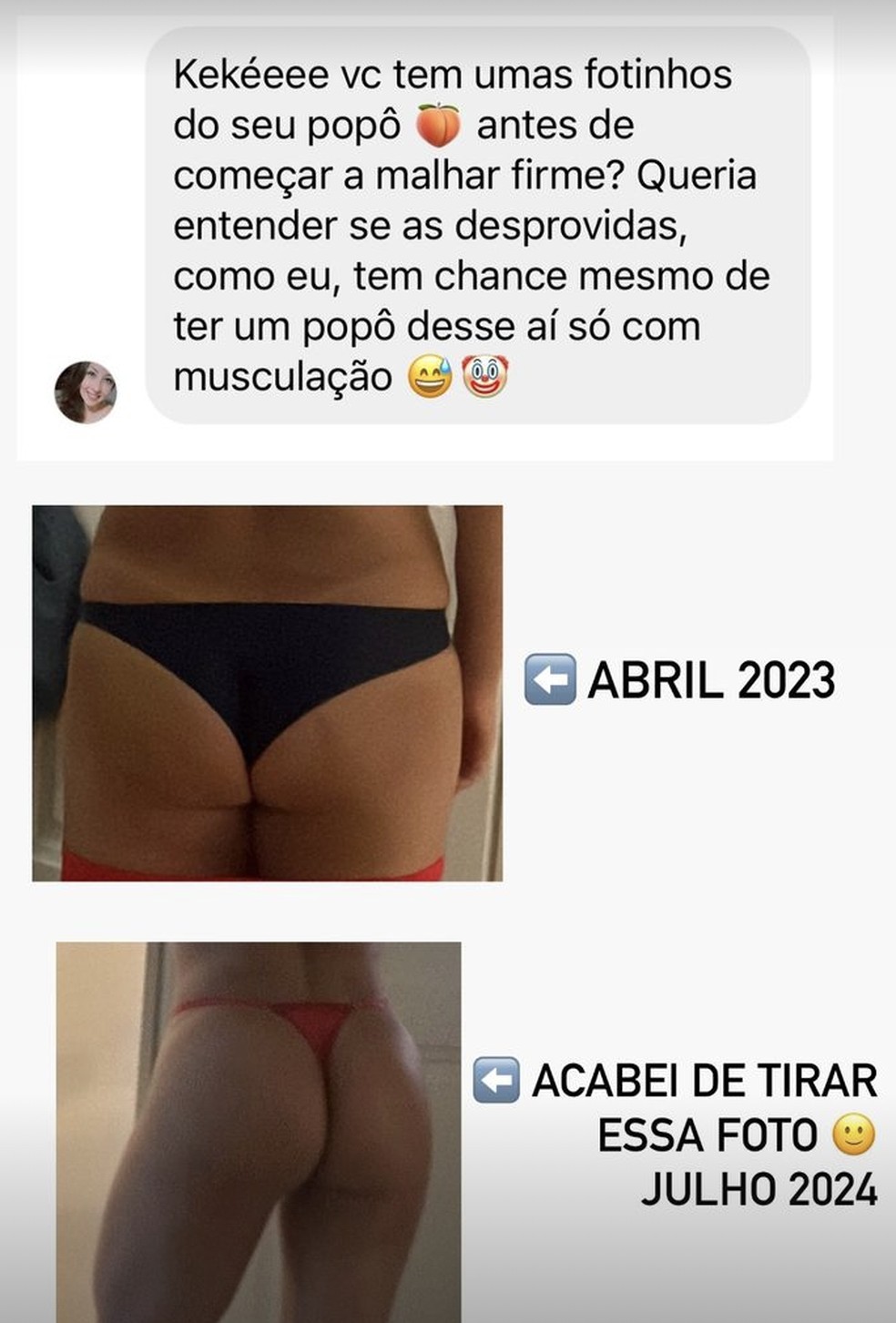 Kéfera mostra antes e depois de glúteos — Foto: Reprodução/Instagram