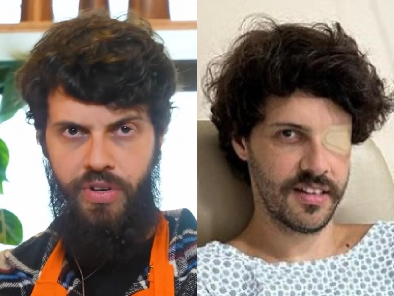 Diogo Defante faz cirurgia para corrigir olho caído e admite ...