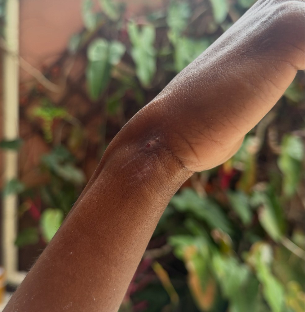 Modelo Dandara Couto mostra marcas pelo corpo após ficar três dias desaparecida — Foto: Reprodução/Instagram
