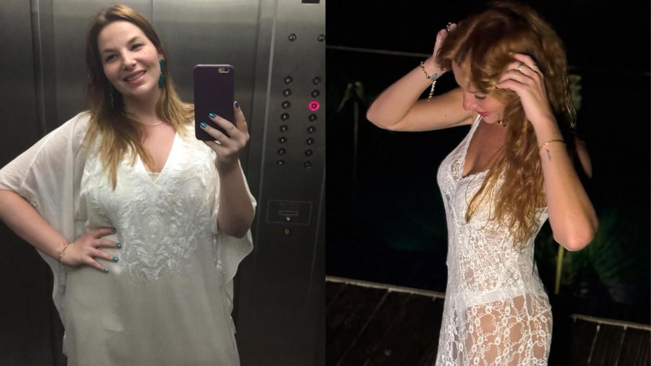 Bariátrica aos 18: jornalista da Globo perde dentes e revela sequelas