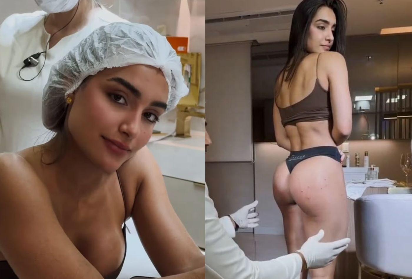 Após Virginia Fonseca, melhor amiga da influenciadora faz harmonização glútea e mostra resultado; vídeo - QTU Questões do Universo