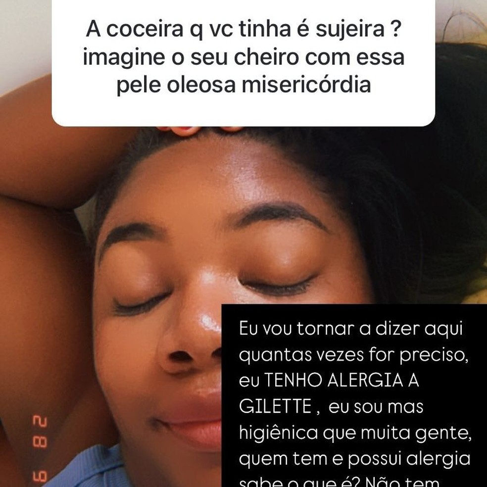 Raquel Brito rebate comentários sobre coceira.