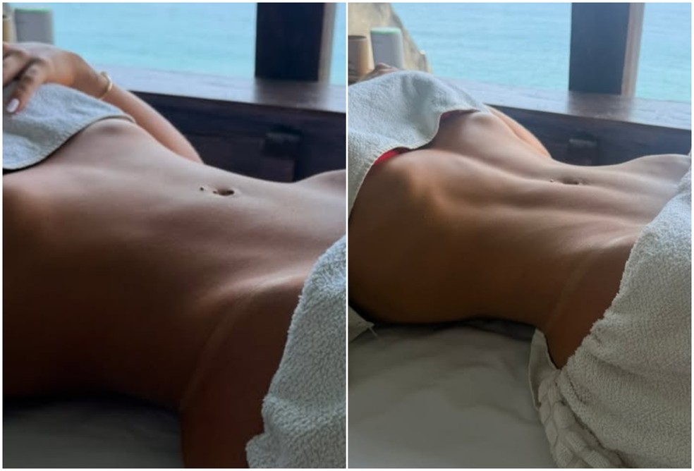 Duda Freire: Antes x depois de massagem modeladora — Foto: Reprodução/Instagram