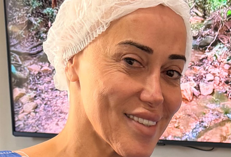 Marcela Porto, a Mulher Abacaxi, antes da feminização facial
