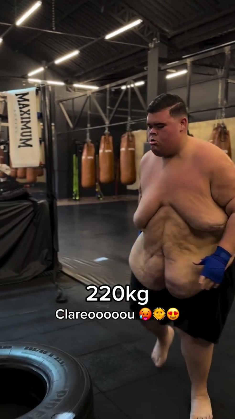Depois de Gordão da XJ, agora com 220 kg — Foto: Reprodução/Instagram