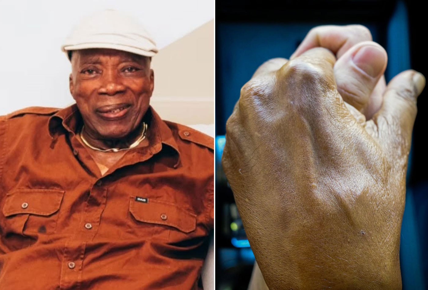 Milton Nascimento deixa hospital após 5 dias com pneumonia
